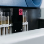 Auffällige Laborwerte ohne Symptome: Was dahinterstecken kann – und wann du handeln solltest
